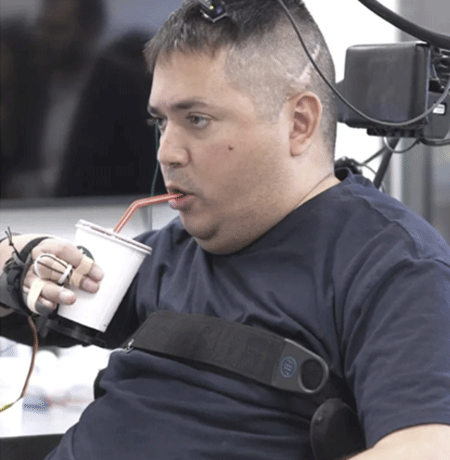 Keith Thomas moving paralyzed limb