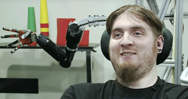 Nathan Copeland's robotic arm