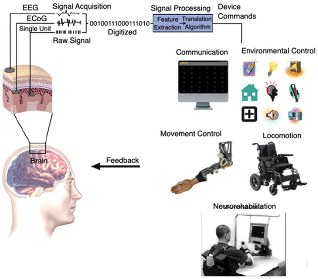 Electrocorticogram schematic